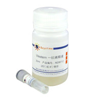 Phospho-Estrogen Receptor α(Ser118)抗体(兔单抗)