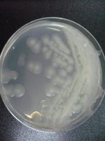 分枝杆菌属图片