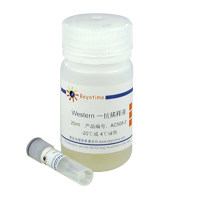 Phospho-Chk2(Thr68)抗体(兔多抗)