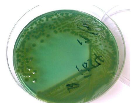 腐殖质类芽孢杆菌培养