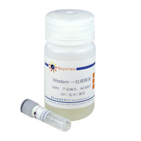 Phospho-Chk1(Ser345)抗体(兔多抗)