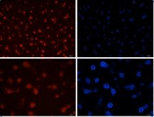 大鼠肝星状细胞 Rat hepatic stellate cells