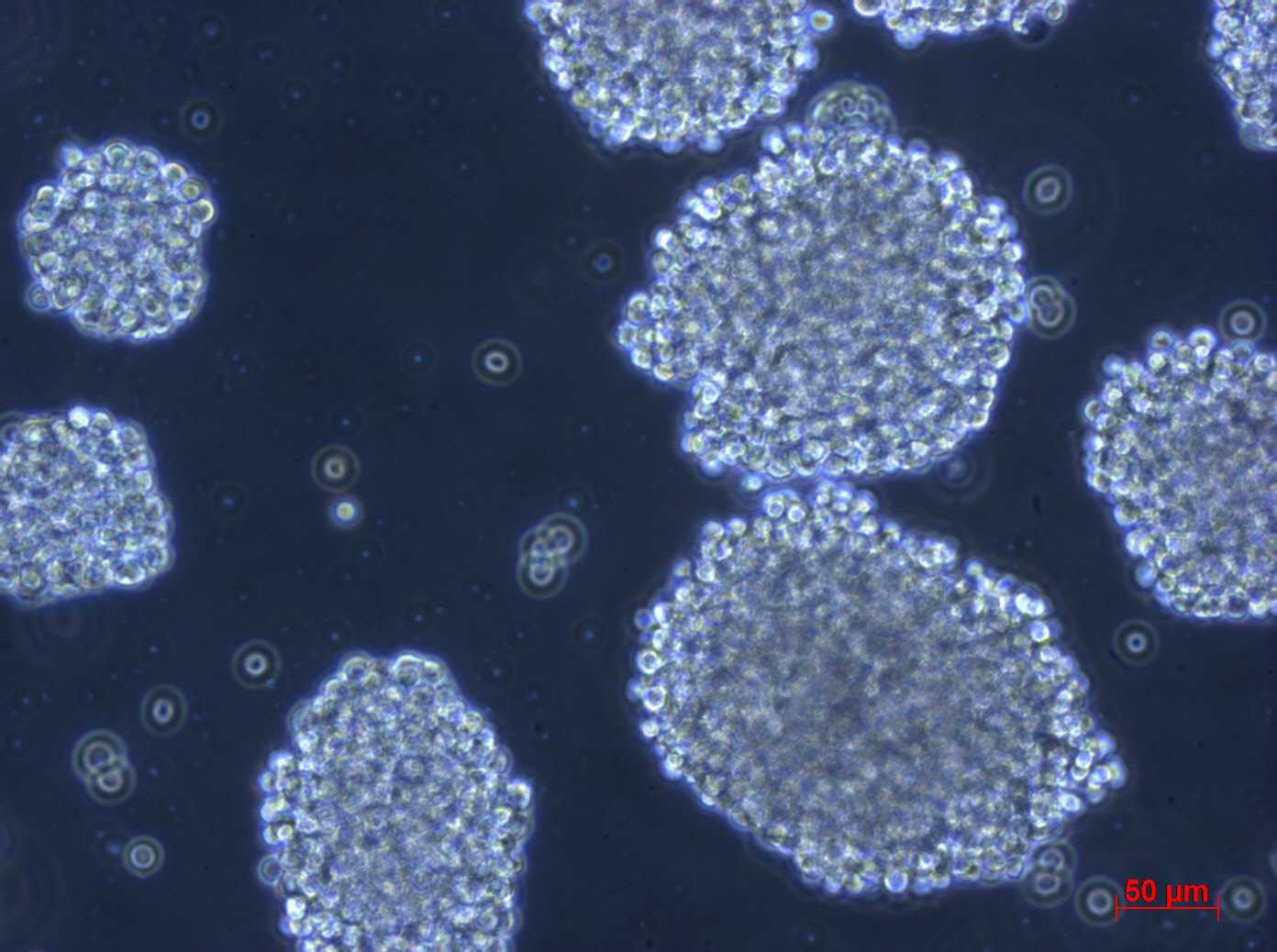 Raji [RAJI; P1-Raji; GM04671]人