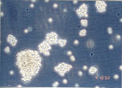 Raji [RAJI; P1-Raji; GM04671]人