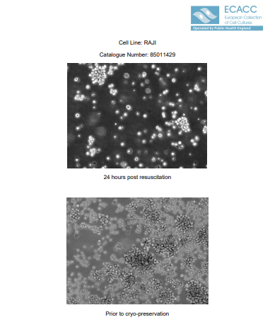 Raji [RAJI; P1-Raji; GM04671]人