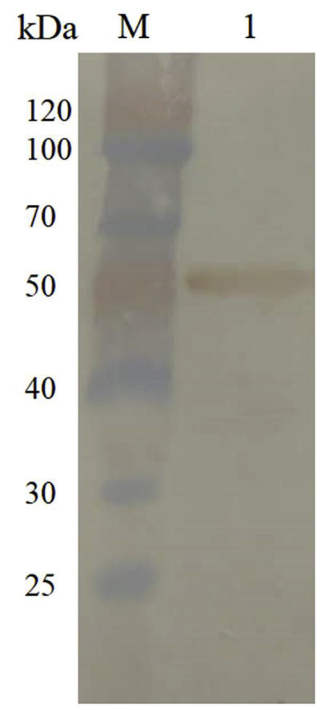 文献解读|大菱鲆溶酶体整合膜蛋白2(LIMP-2)的鉴定及功能初步分析