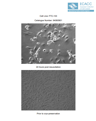 FTC-133[	FTC133]人甲状腺癌细胞