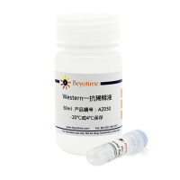 THRB Rabbit Polyclonal Antibody