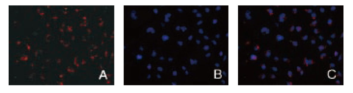 RNAi实验沉默效果不佳，这个步骤不可忽视！