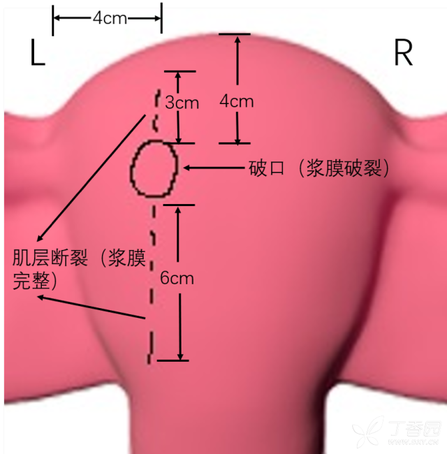 图片 2.png