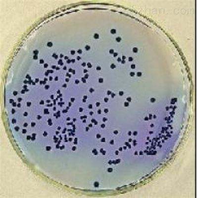 梭形芽孢杆菌