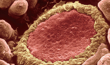 小鼠胚胎成纤维细胞，NIH3T3多少钱