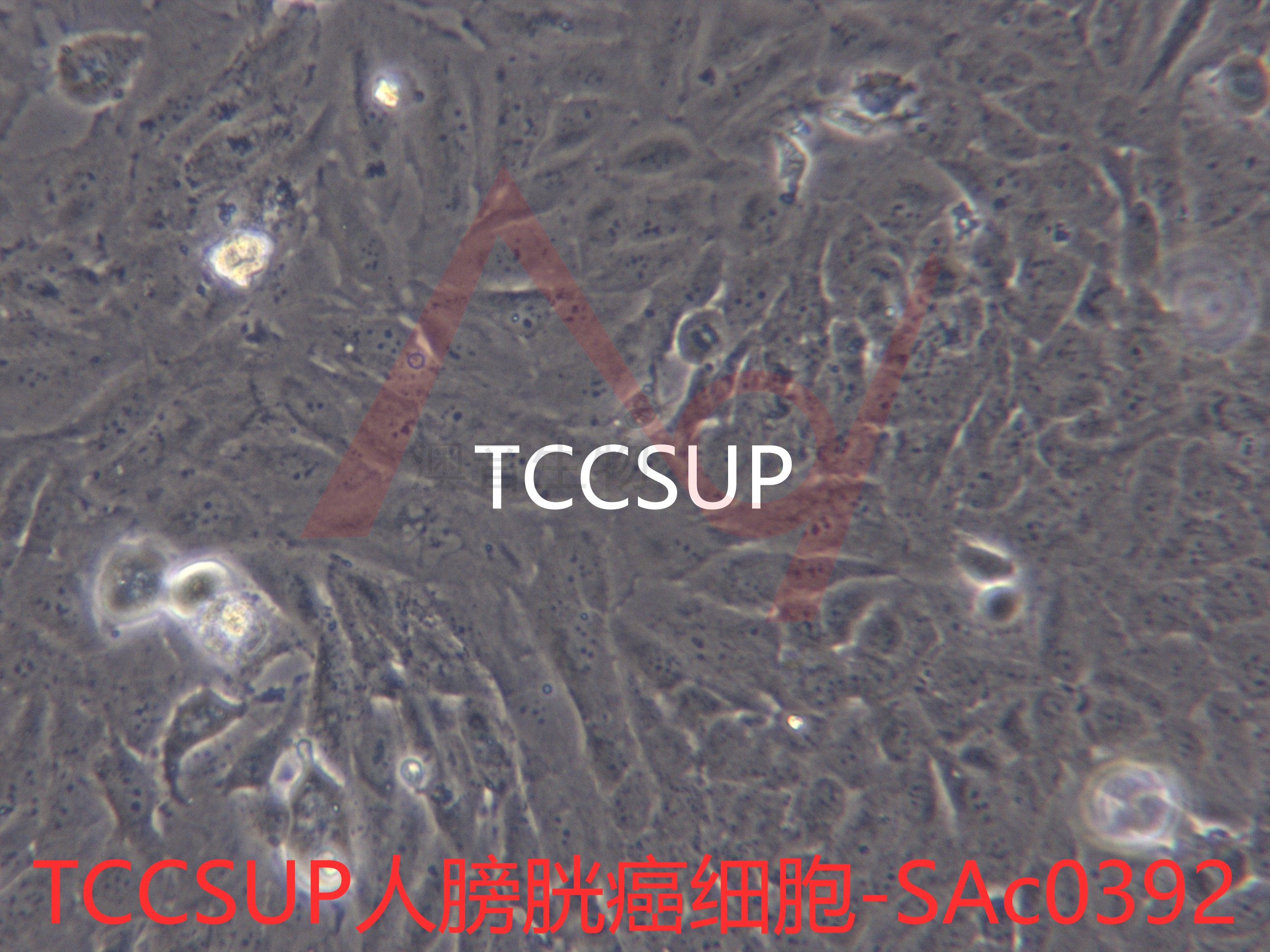 TCCSUP[TCCSuP; TCC-SUP; TCC Sup]膀胱癌细胞