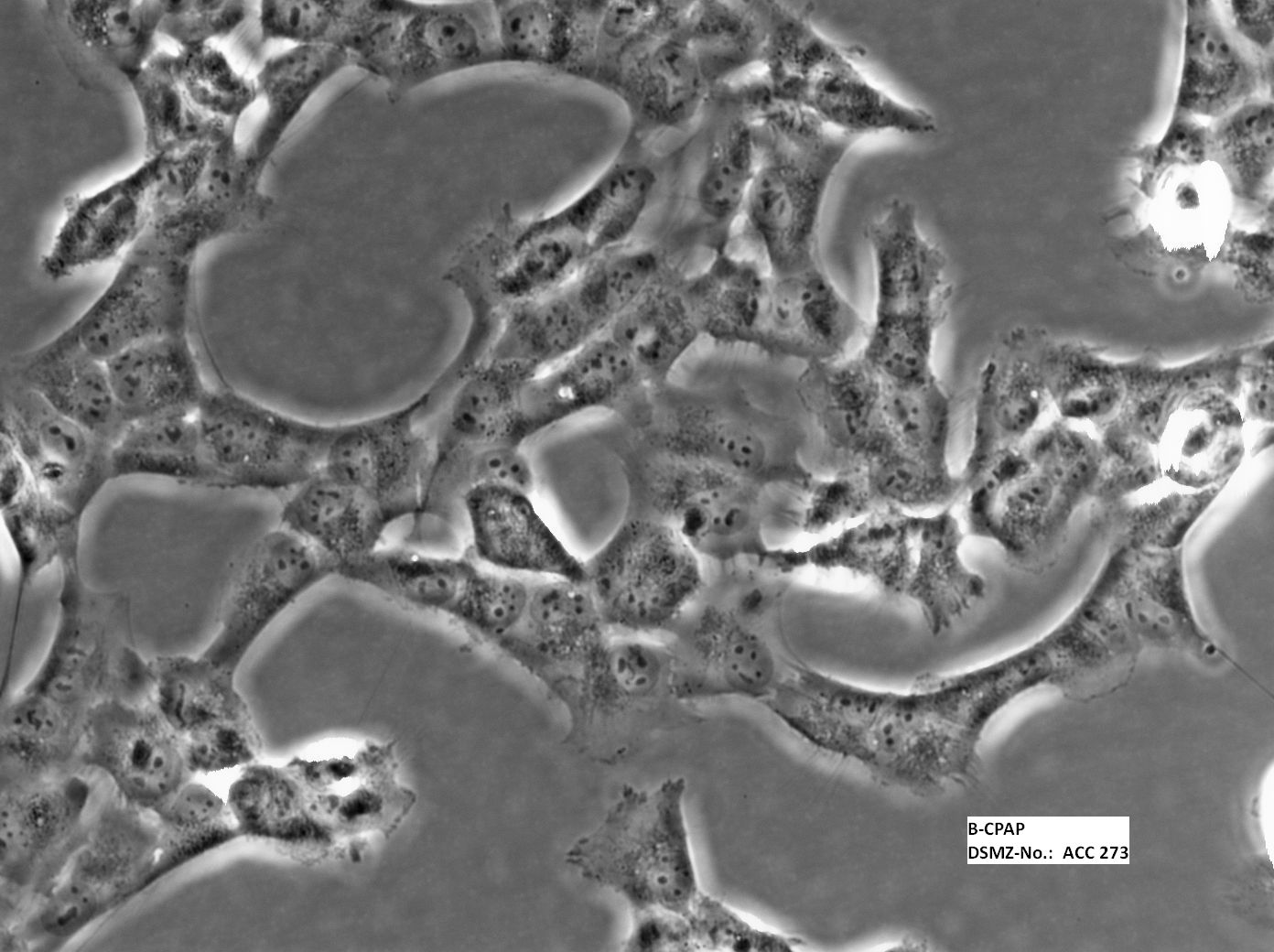 B-CPAP[BC-PAP; BCPAP]人甲状腺癌细胞