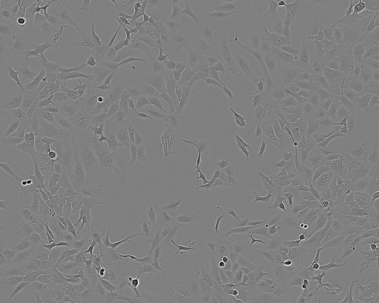 SK-OV-3-LUC-GFP-Puro[SKOV-3-LU