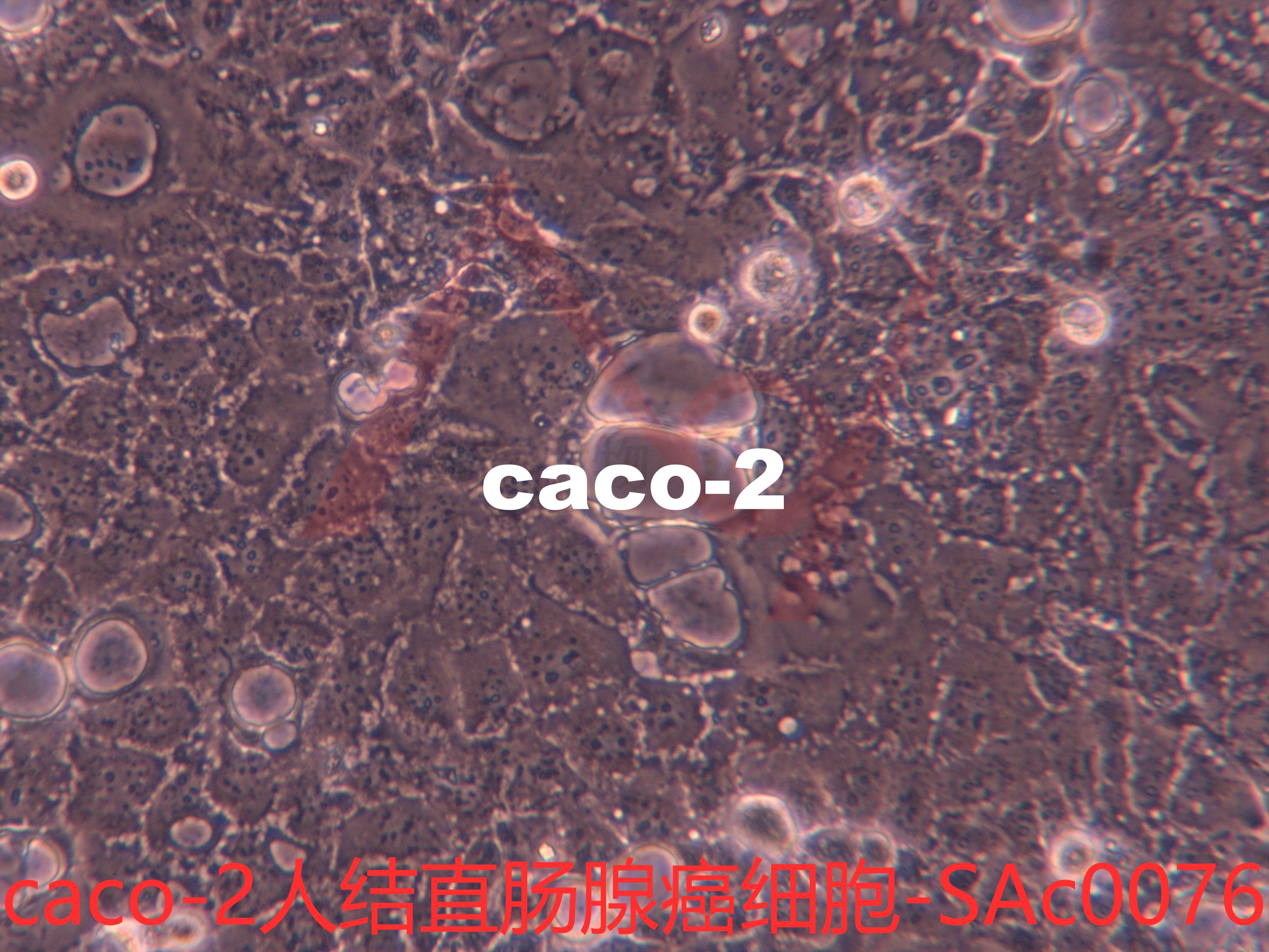 Caco-2[CaCo-2; CACO-2; Caco 2; CACO 2; CACO2; CaCo2; CaCO2; Caco2; Caco-2/ATCC]结直肠腺癌细胞