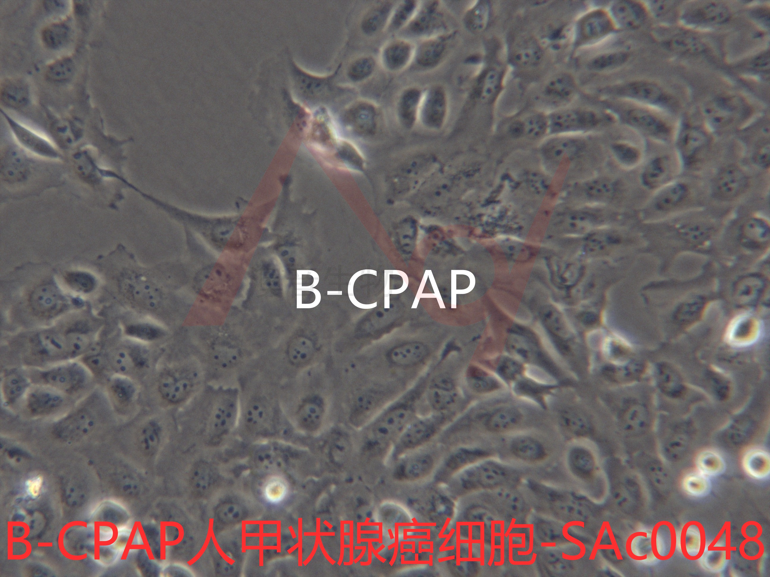 B-CPAP[BC-PAP; BCPAP]人甲状腺癌细胞