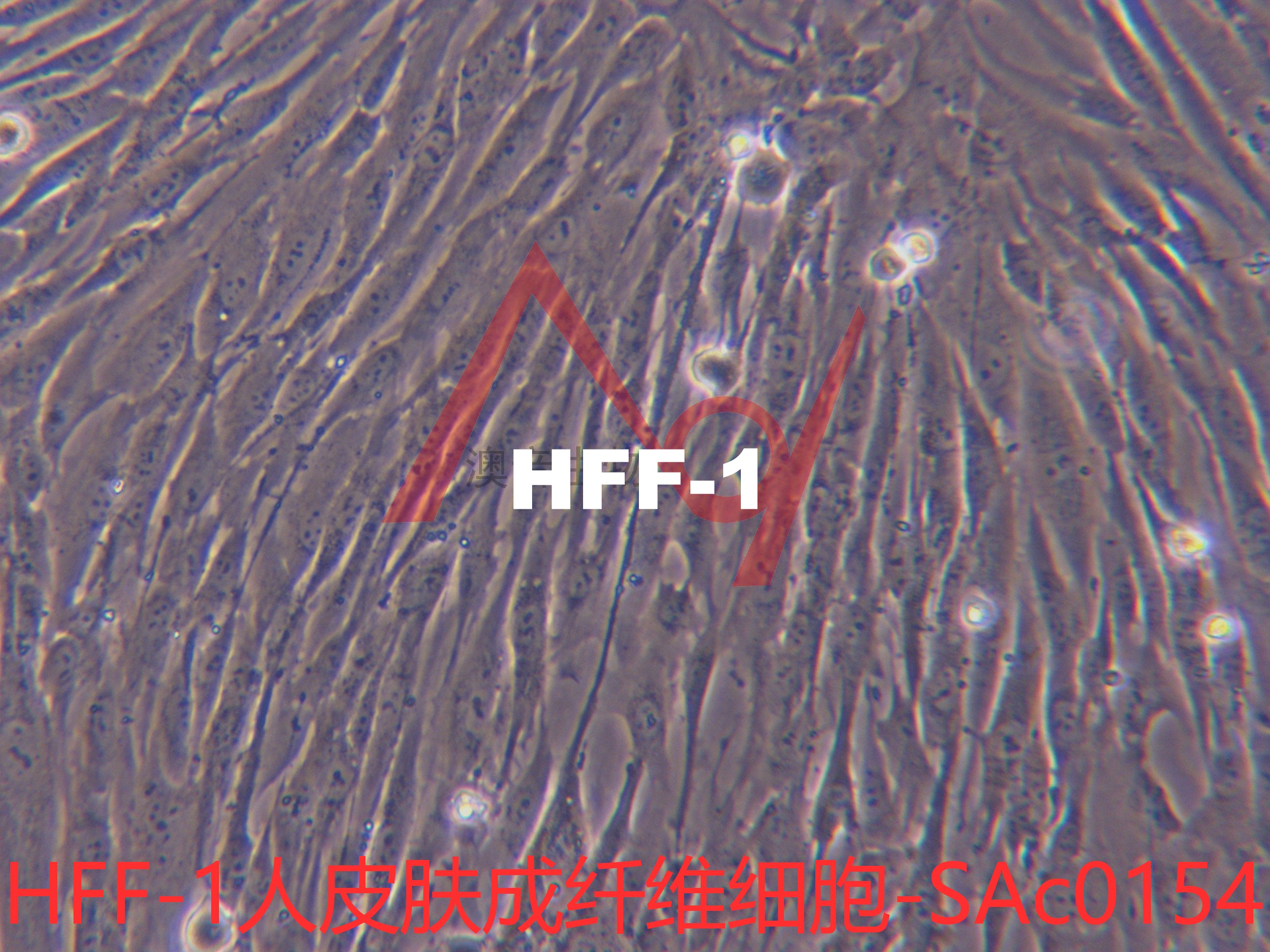 HFF-1[HFF1]人皮肤成纤维细胞