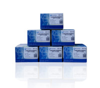 札如病毒/腺病毒/星状病毒探针法三重RT-PCR试剂盒