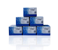 人冠状病毒通用探针法RT-PCR试剂盒