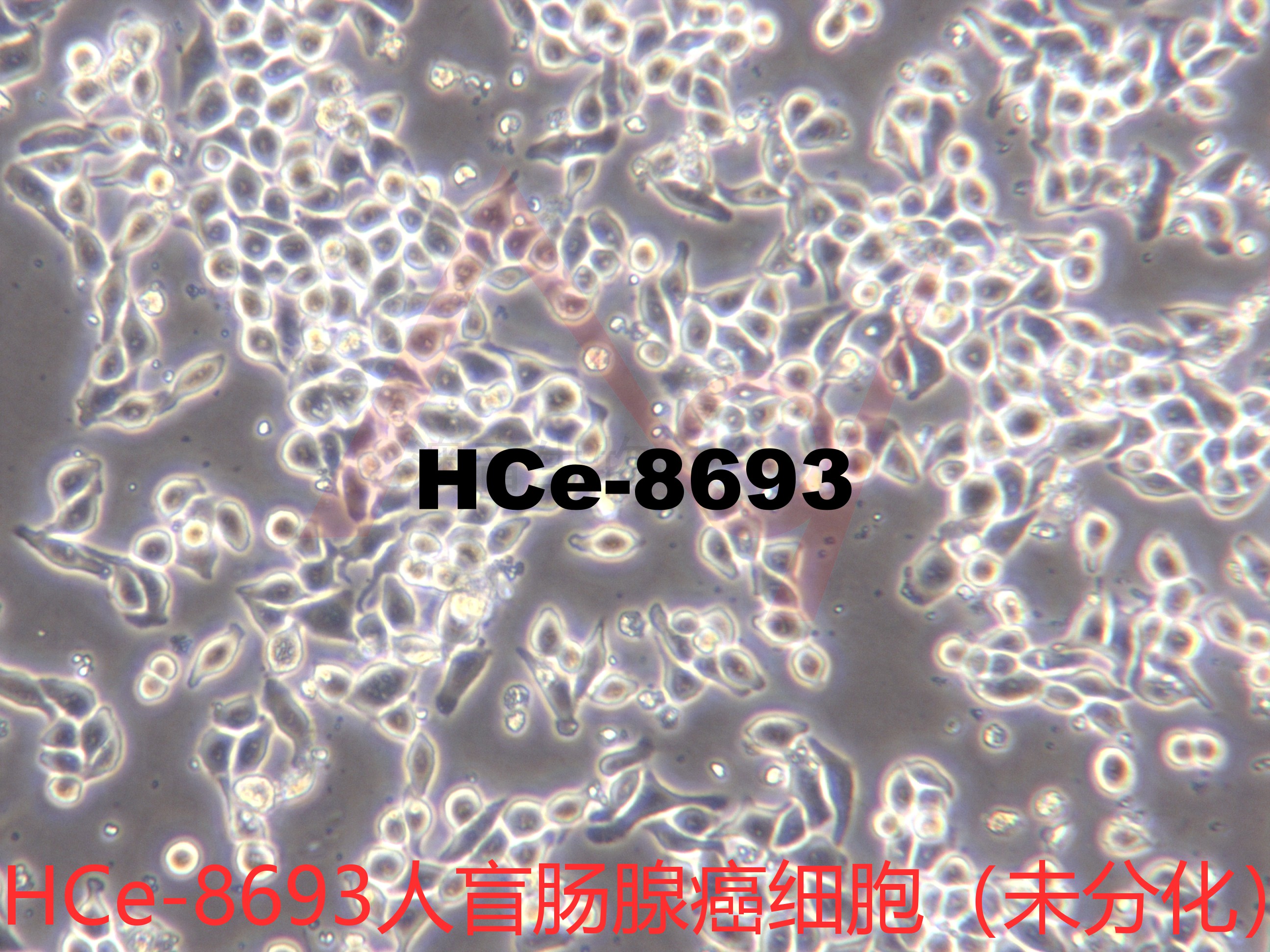 HCe-8693[Hce-8693; HCE-8693; Hce8693; HCE8693]人盲肠腺癌细胞（未分化）