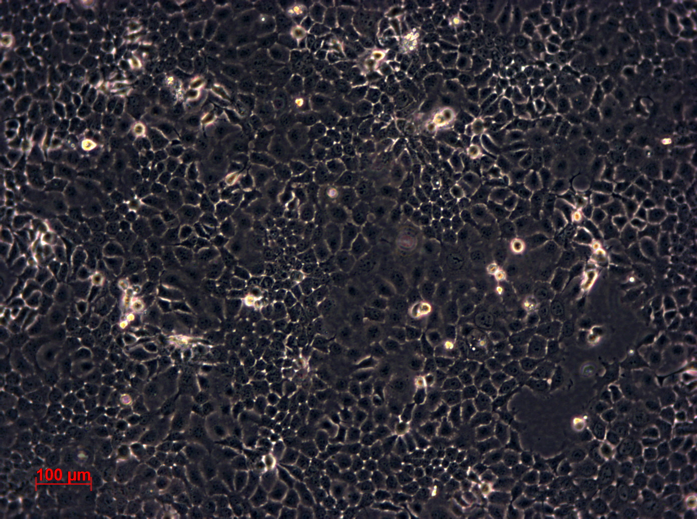 FaDu[FaDU; FADU]人咽鳞癌细胞