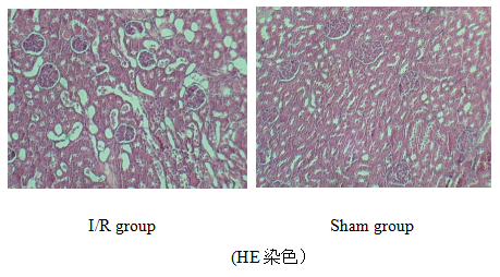 肾缺血再灌注损伤模型  