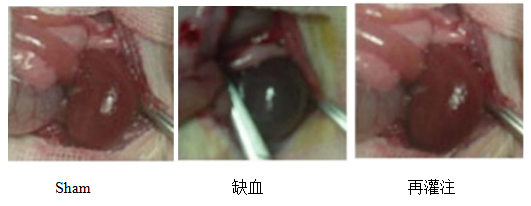 肾缺血再灌注损伤模型  