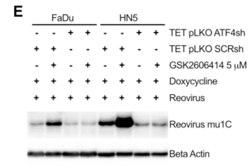 CELL子刊丨PERK抑制剂GSK2606414增强呼肠孤溶瘤病毒对头颈部鳞癌的治疗效果