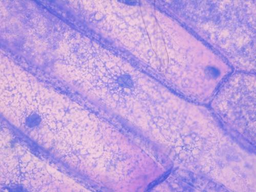非洲绿猴肾细胞系/HCV-p7图片