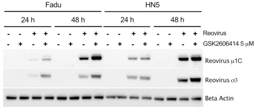 CELL子刊丨PERK抑制剂GSK2606414增强呼肠孤溶瘤病毒对头颈部鳞癌的治疗效果