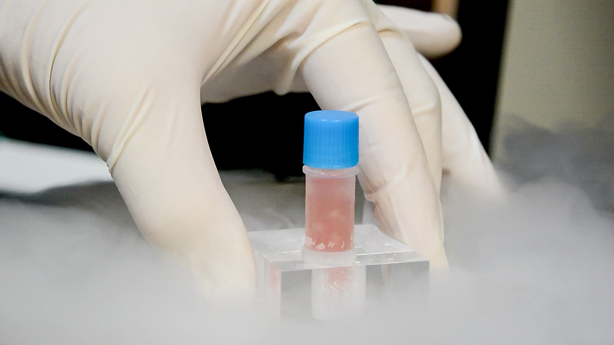 panc-1人胰腺癌细胞panc-1(2013年新引进)(复苏包邮;或可提供冻存管)