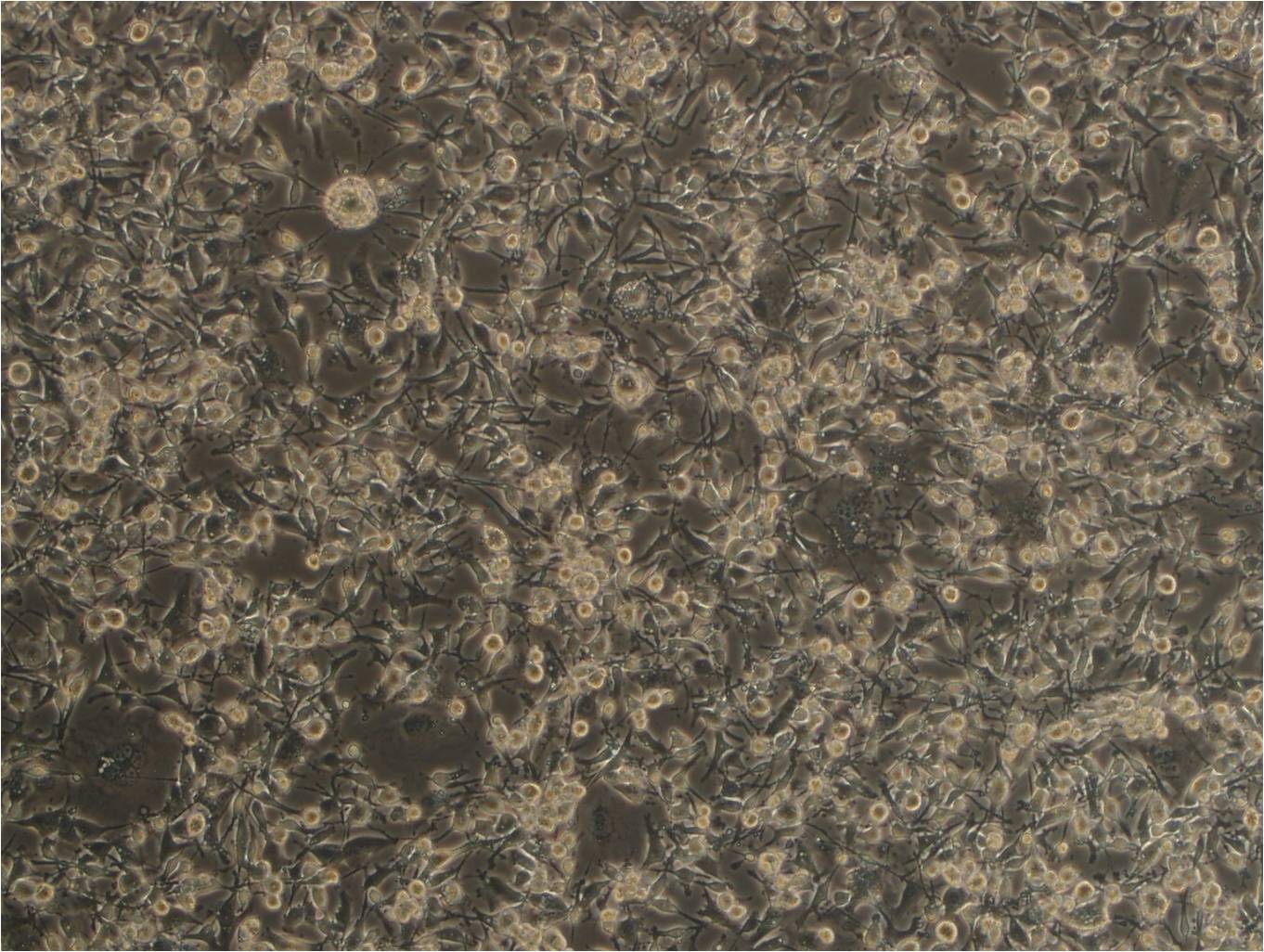 MDA-MB-436【MDA MB 436; MDA-Mb-