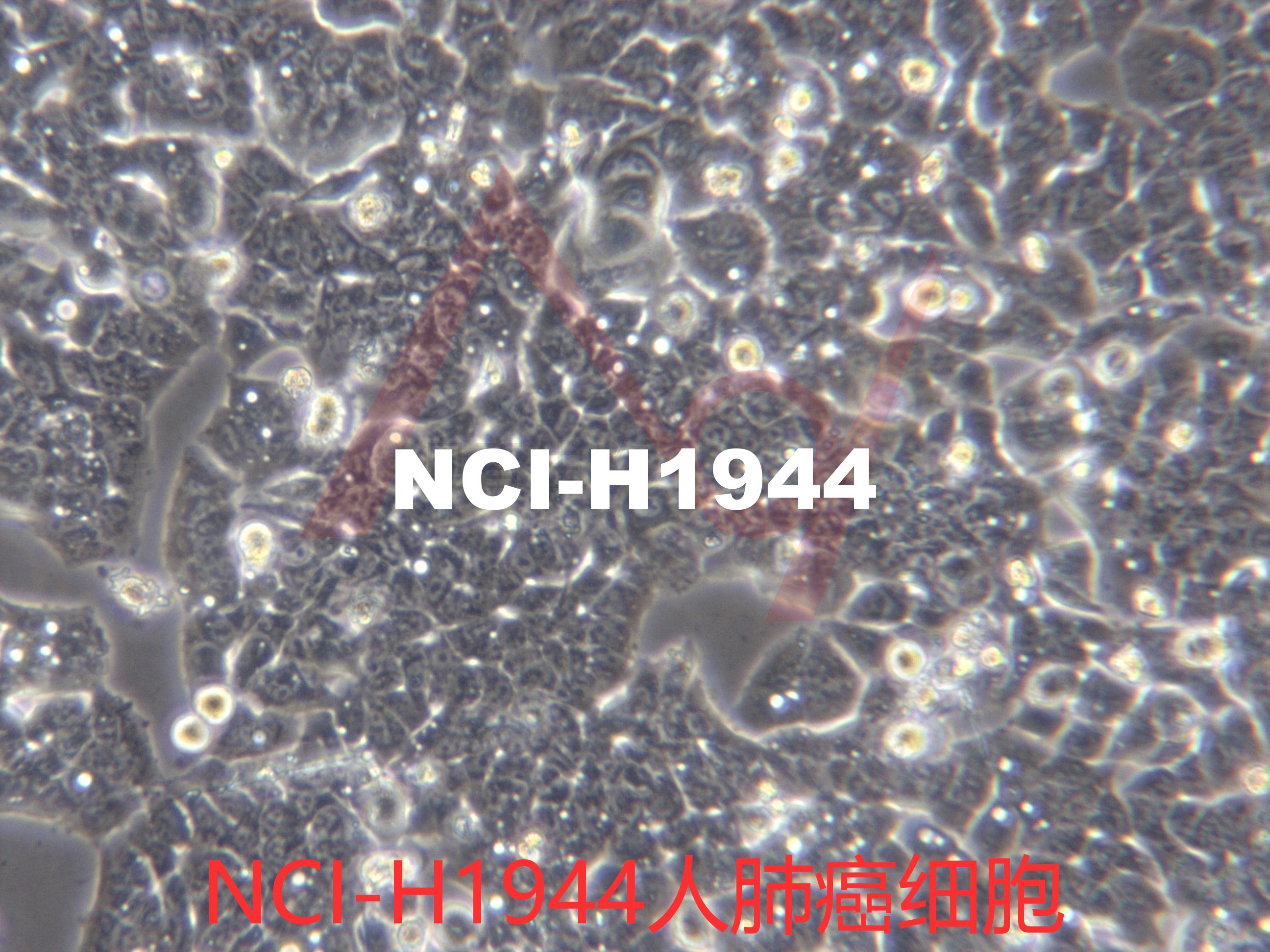 NCI-H1944[H1944; H-1944; NCIH1944]人肺癌细胞
