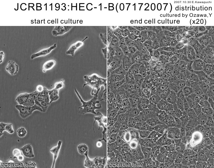 HEC-1-B【Hec-1-B; HEC-1B; Hec-1