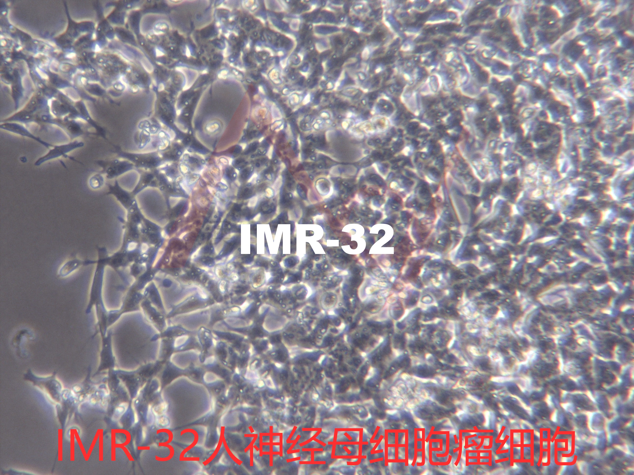 IMR-32【IMR-32;IMR 32; imr-32;IMR32】神经母细胞瘤细胞