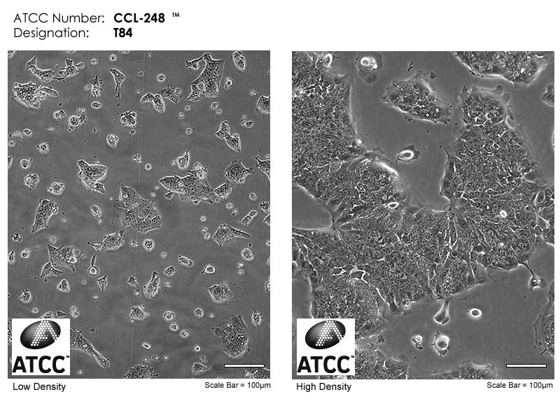 T84【T-84; T 84】结肠腺癌肺转移细胞