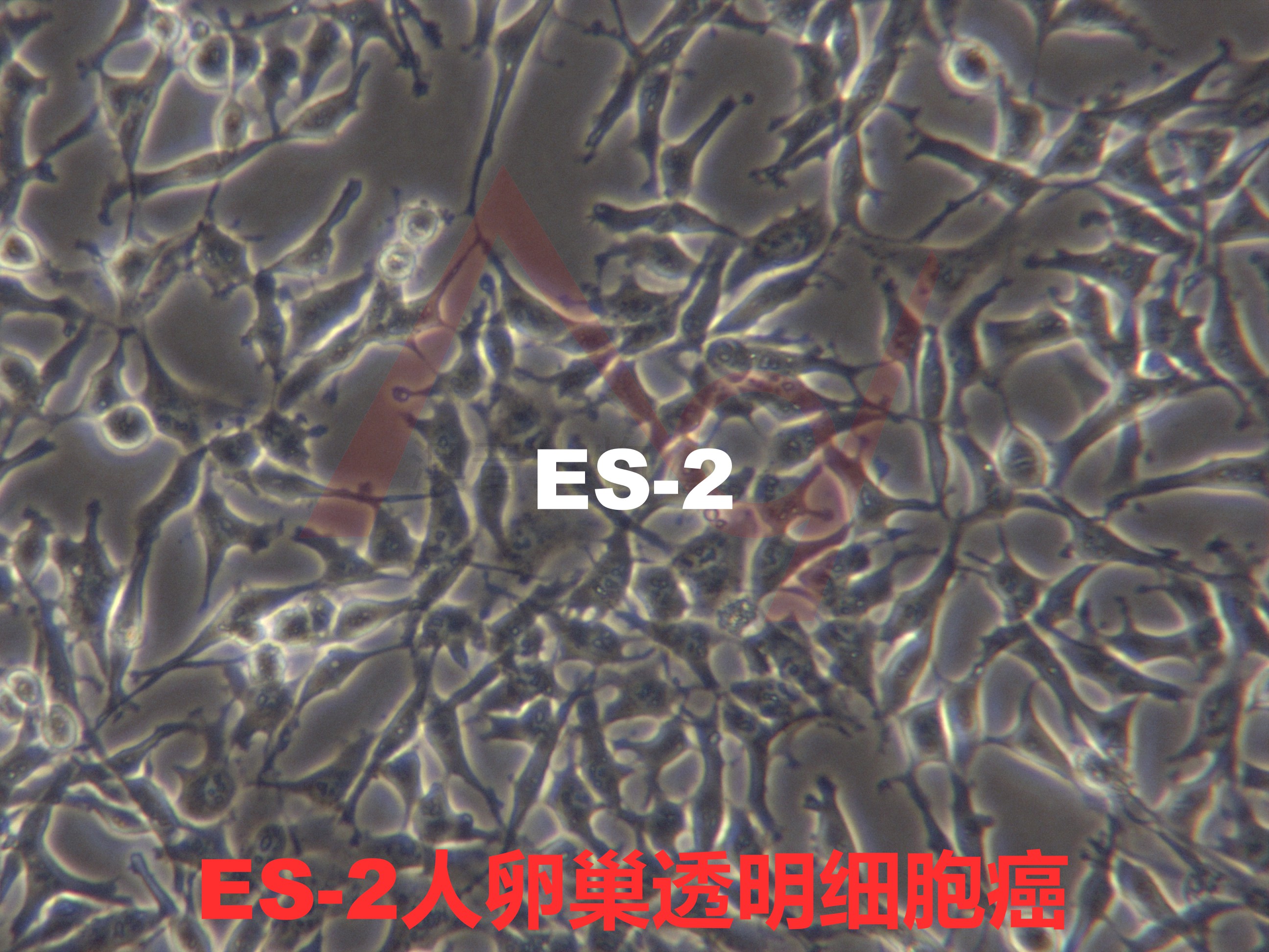 ES-2【ES2】人卵巢透明细胞癌