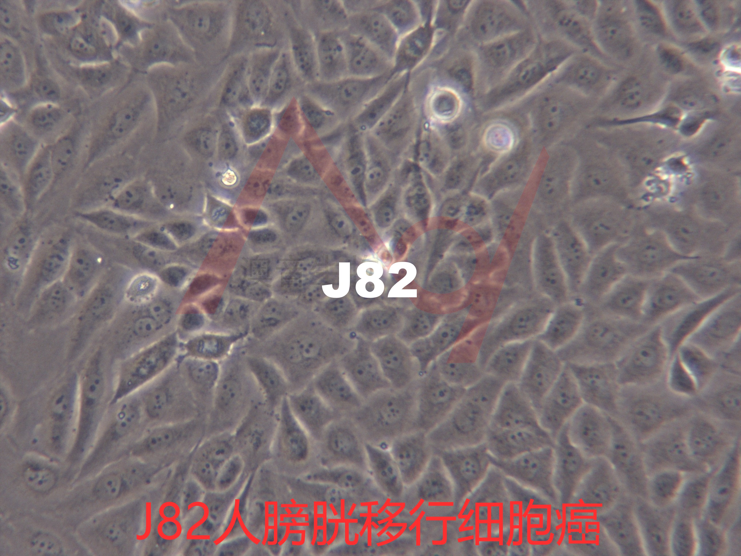J82【J-82; J 82; J82COT; J82 COT】人膀胱移行细胞癌