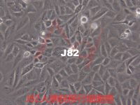 J82【J-82; J 82; J82COT; J82 COT】人膀胱移行细胞癌