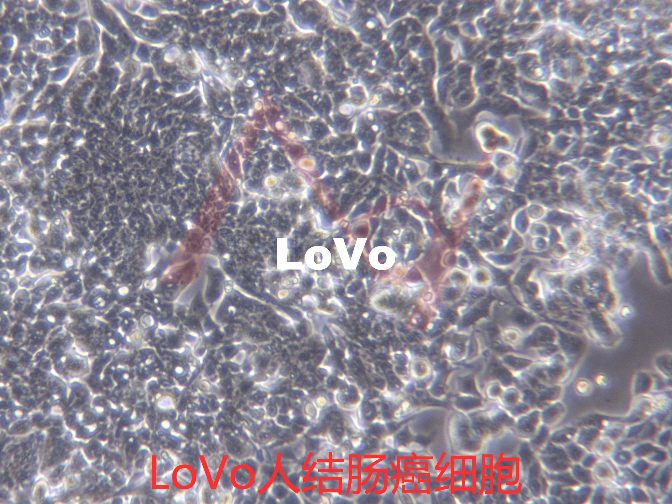 LoVo【LOVO】结肠癌细胞