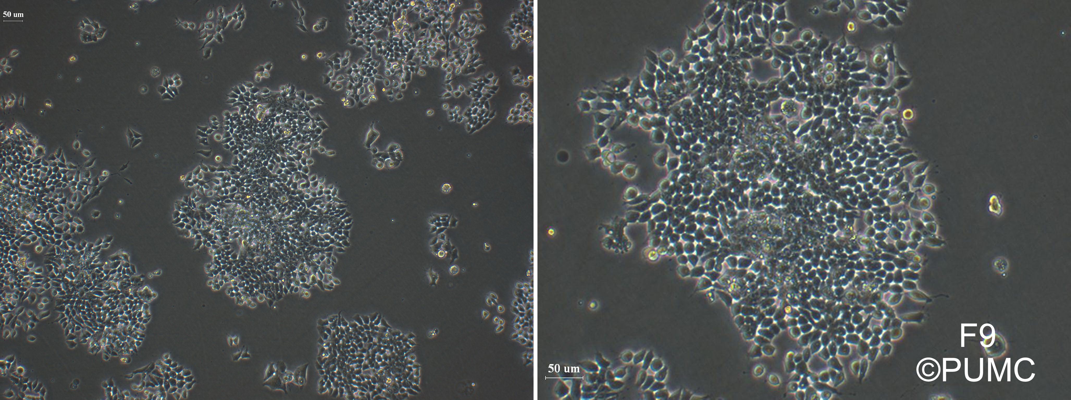 F9|F9细胞|小鼠畸胎瘤细胞