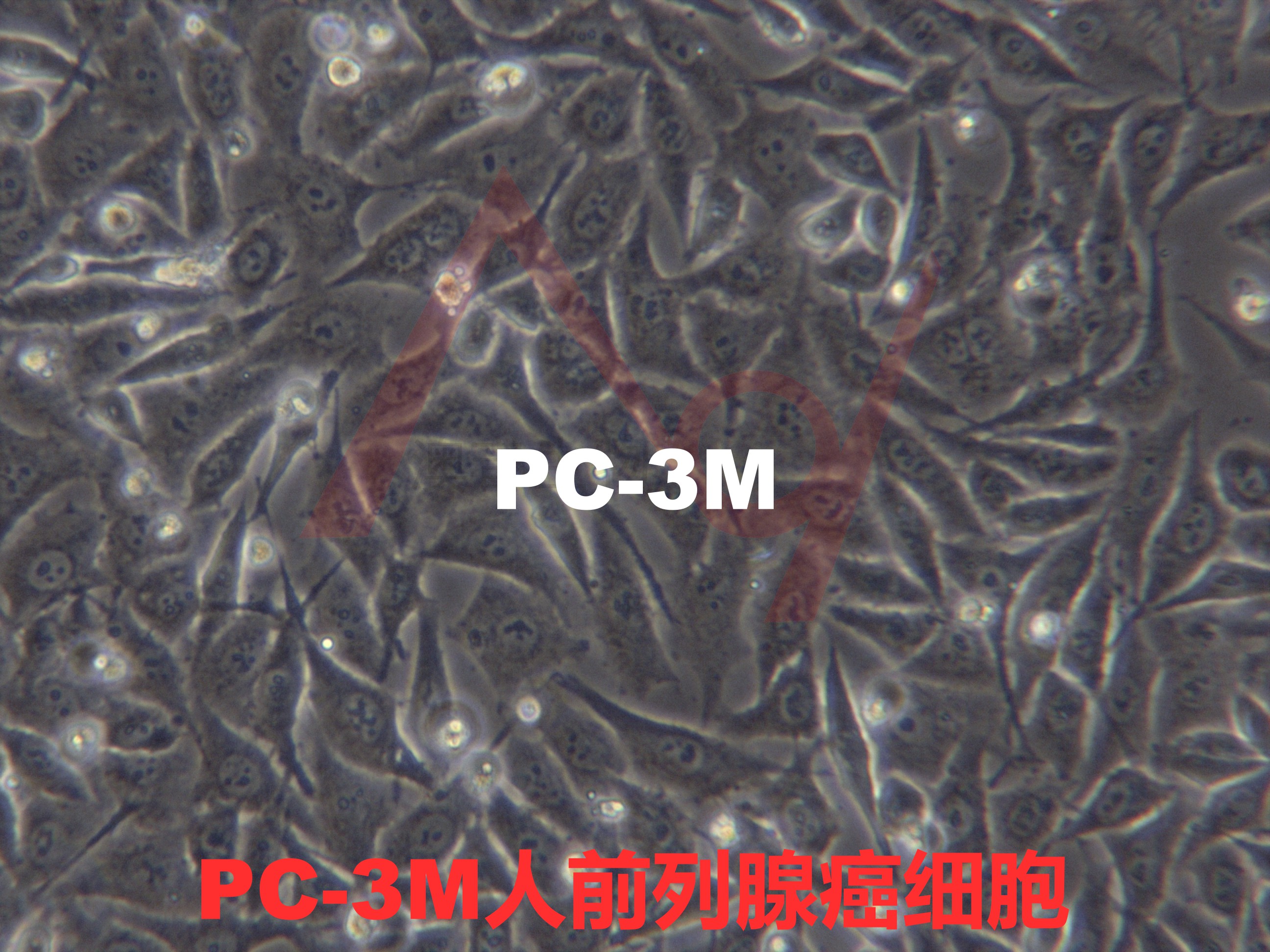 PC-3M[PC3-M; PC-3/M; PC3M; Pc3M]人前列腺癌细胞