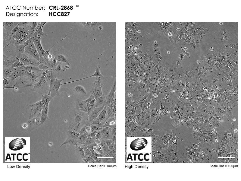 HCC827-LUC-GFP-Puro[hcc827-luc