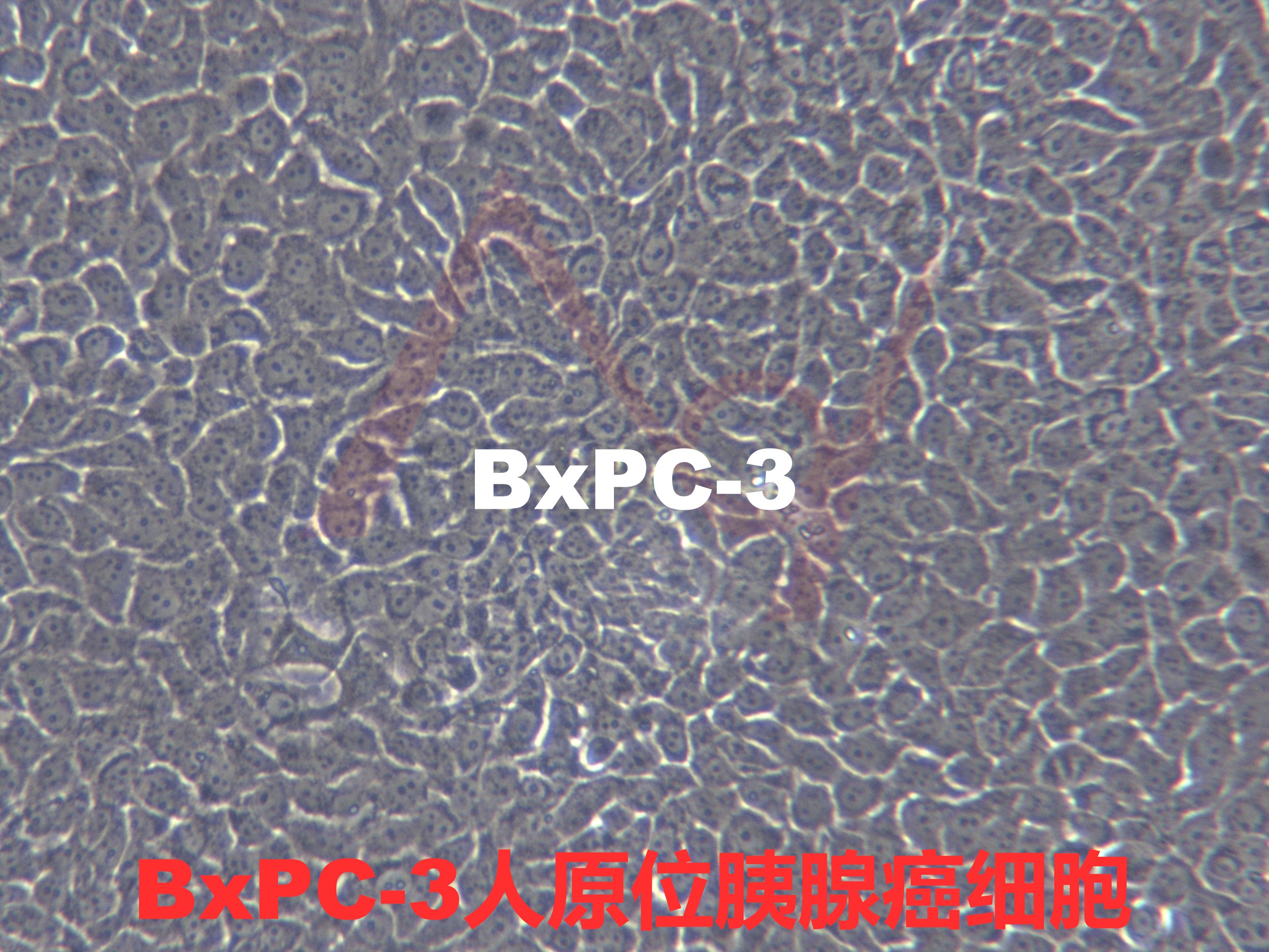 BxPC-3【BxPc-3; BXPC-3; Bx-PC3; BXPC3; BxPC3; BxPc3; Biopsy xenograft of Pancreatic Carcinoma line-3】原位胰腺癌细胞