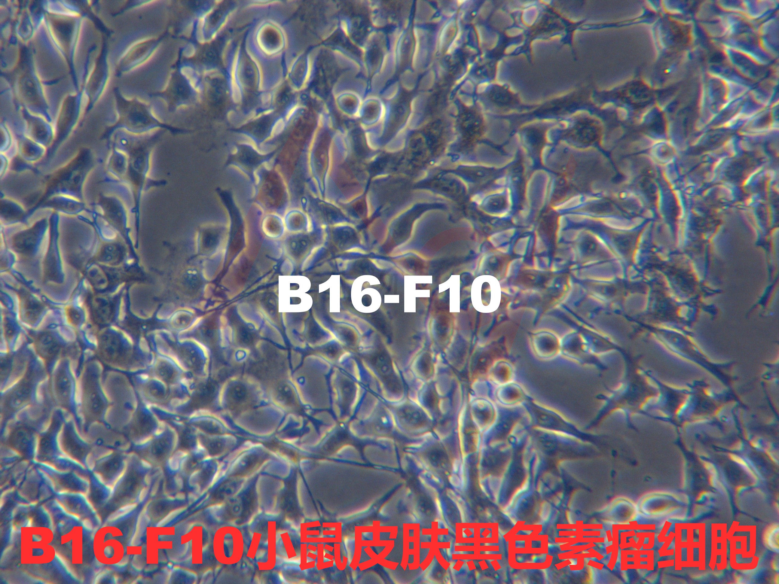 B16-F10[B16/F10; B16 F10; B16F10; B16 melanoma F10]小鼠皮肤黑色素瘤细胞产品图
