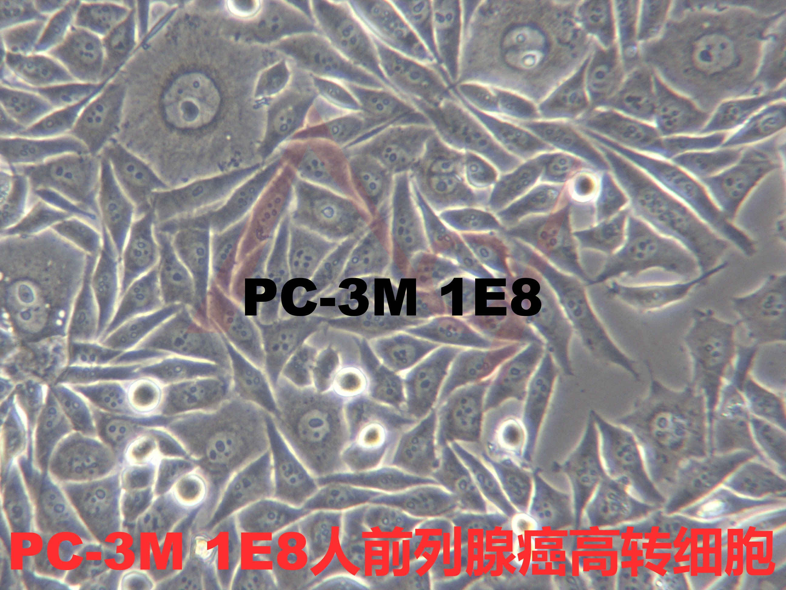 PC-3M-1E8【PC-3M IE8; PC-3M-IE8; PC3M-1E8; PC3M-IE8; 1E8-H】人前列腺癌高转细胞
