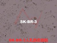 SK-BR-3[SK-Br-3; Sk-Br-3; SK BR 03; SKBR-3; SKBr-3; SK-BR3; SKBr3; SkBr3; SKBR3]乳腺腺癌细胞