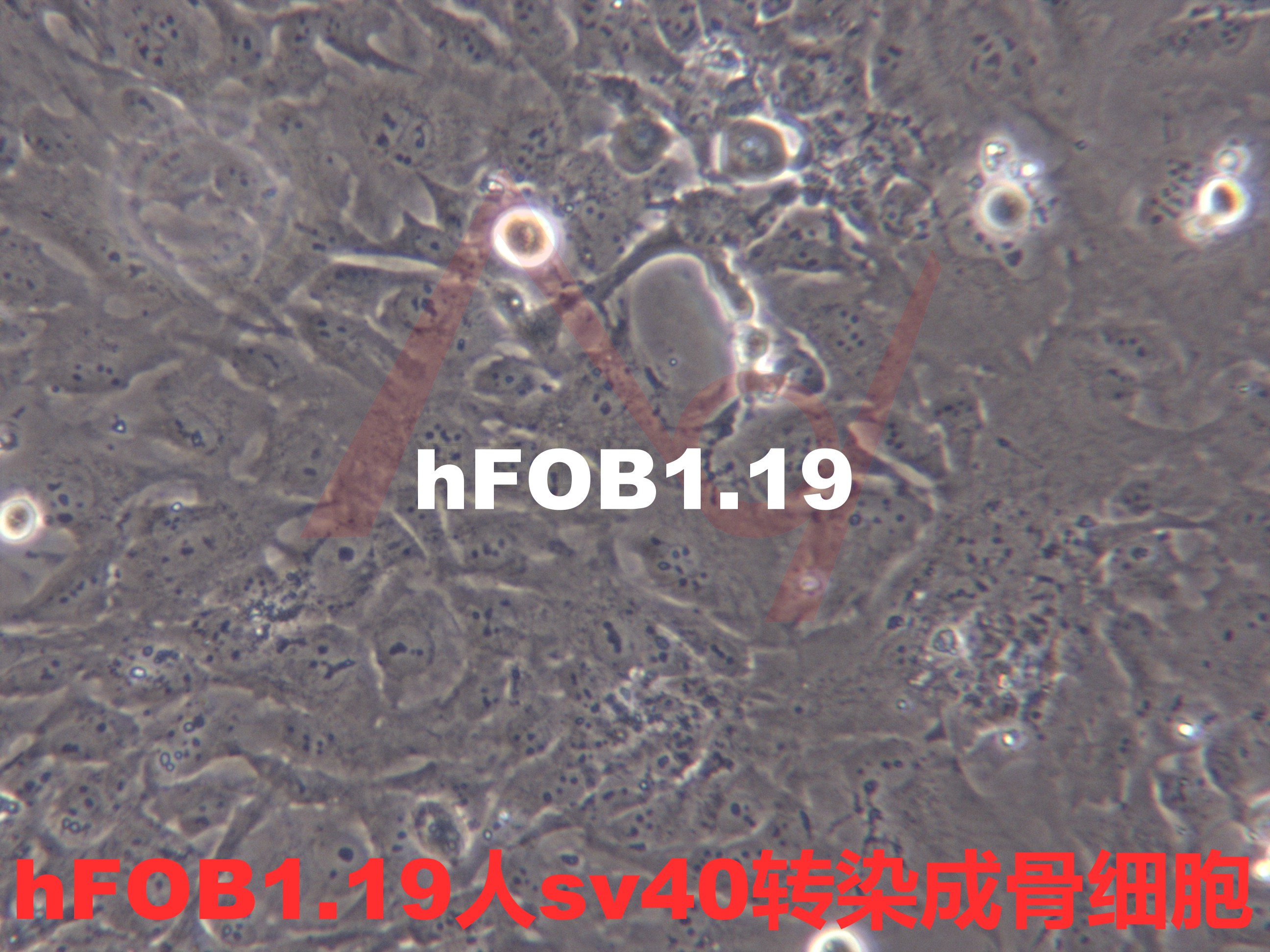 hFOB 1.19[hFOB1.19; hFOB]人SV40转染成骨细胞
