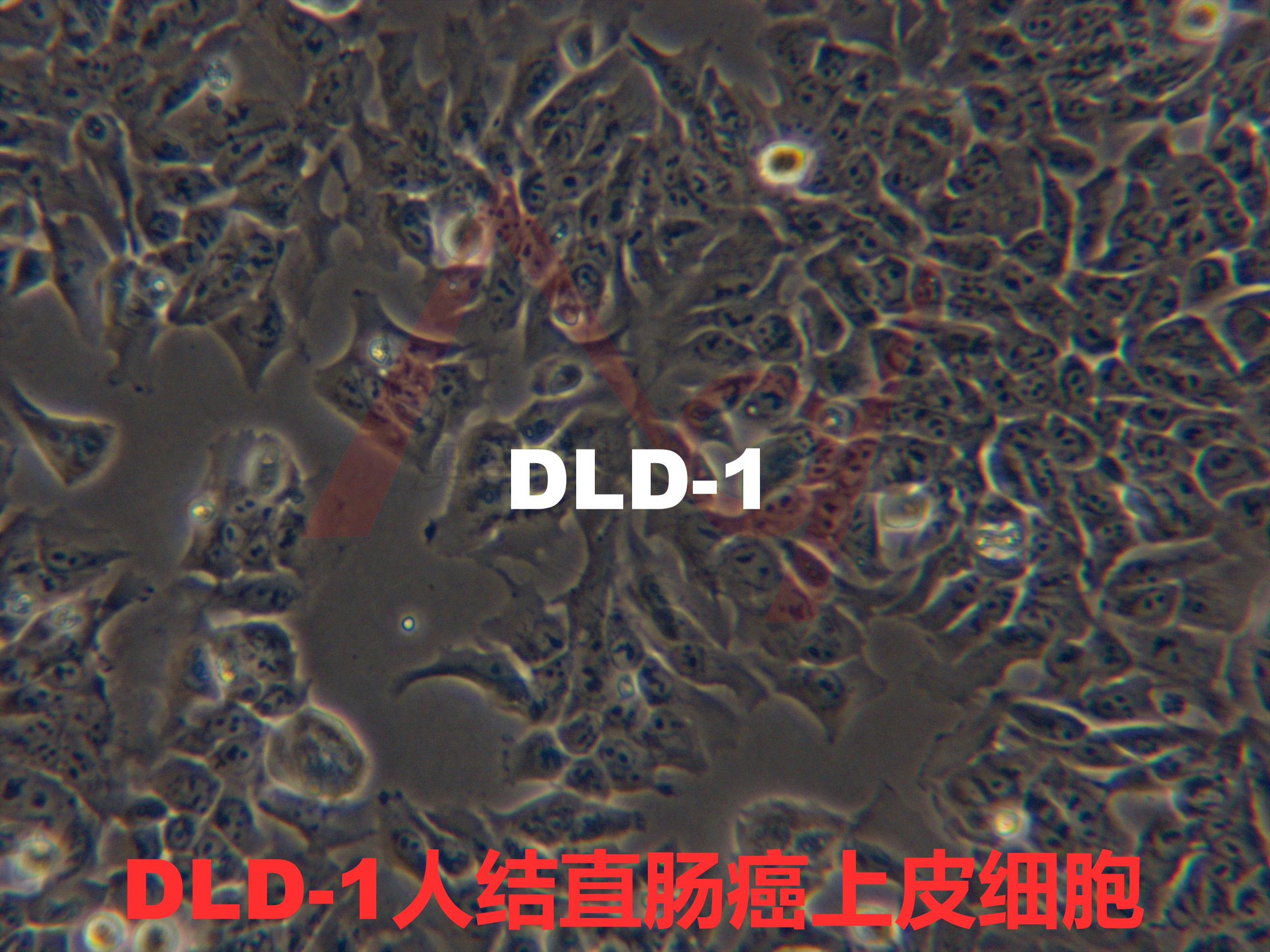 DLD-1[DLD 1; DLD1; CoCL3]人结直肠癌上皮细胞